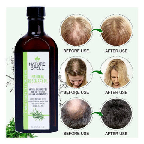 Rosemary Oil for Hair Growth-Items Online Rosemary Oil for Hair Growth-Items Online