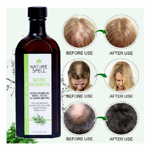  Rosemary Oil for Hair Growth